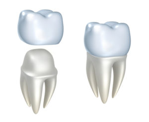 each-of-our-porcelain-crowns-is-designed-from-quality-porcelain-or-metal-free-bruxir-zirconia-materials-to-restore-the-beauty-and-function-of-teeth