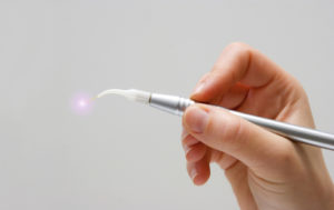 hand-with-dental-laser-system-000019128512_medium